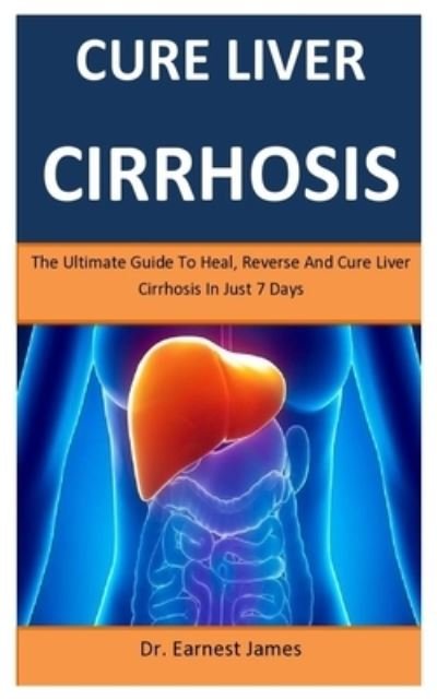 Cure Liver Cirrhosis - James - Libros - Independently Published - 9781698363141 - 7 de octubre de 2019
