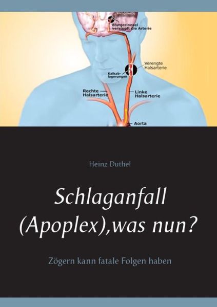 Cover for Heinz Duthel · Schlaganfall (Apoplex), Was Nun? (Paperback Book) (2015)