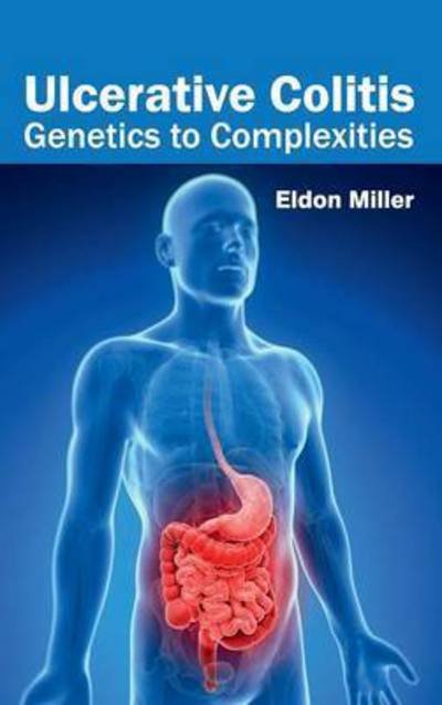 Cover for Eldon Miller · Ulcerative Colitis: Genetics to Complexities (Hardcover Book) (2015)