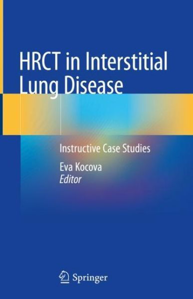 HRCT in Interstitial Lung Disease: Instructive Case Studies (Hardcover Book) [1st ed. 2019 edition] (2019)