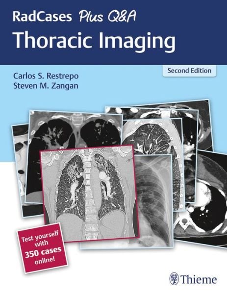 RadCases Plus Q&A Thoracic Imaging - Radcases Plus Q&A - Restrepo Carlos S. - Books - Thieme Medical Publishers Inc - 9781626238145 - January 23, 2019