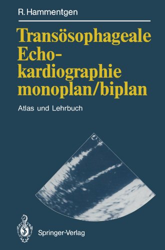 Cover for Ralf Hammentgen · Transosophageale Echokardiographie Monoplan / Biplan (Paperback Book) [Softcover Reprint of the Original 1st Ed. 1991 edition] (2011)