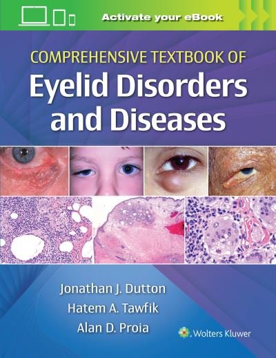 Comprehensive Textbook of Eyelid Disorders and Diseases - Dutton, Jonathan, MD, PhD - Livres - Wolters Kluwer Health - 9781975146146 - 12 novembre 2022