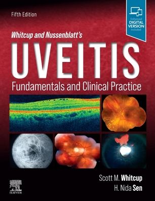 Cover for Scott M. Whitcup MD · Whitcup and Nussenblatt's Uveitis : Fundamentals and Clinical Practice (Hardcover Book) (2021)