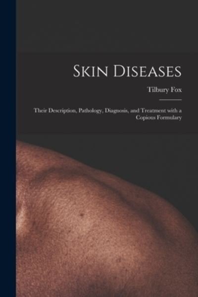 Cover for Tilbury 1836-1879 Fox · Skin Diseases [electronic Resource] (Paperback Book) (2021)