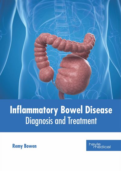 Cover for Remy Bowen · Inflammatory Bowel Disease: Diagnosis and Treatment (Hardcover Book) (2019)