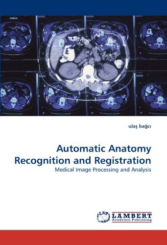 Automatic Anatomy Recognition and Registration: Medical Image Processing and Analysis - Ula? Ba?c? - Books - LAP LAMBERT Academic Publishing - 9783838380148 - August 3, 2010