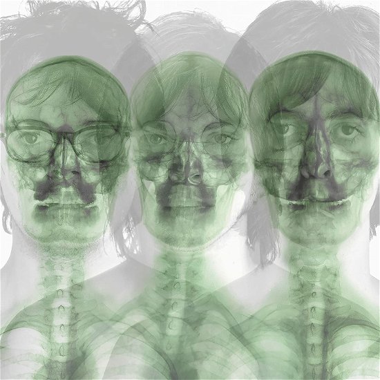 Cover for Supergrass (LP) [Coloured edition] (2022)
