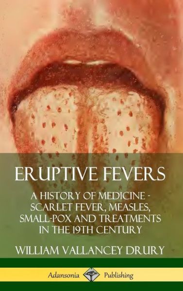 Cover for William Vallancey Drury · Eruptive Fevers A History of Medicine - Scarlet Fever, Measles, Small-Pox and Treatments in the 19th Century (Hardcover Book) (2019)