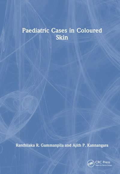 Cover for Gammanpila, Ranthilaka R. (Teaching Hospital Kalutara, Sri Lanka) · Paediatric Cases in Coloured Skin (Paperback Book) (2023)