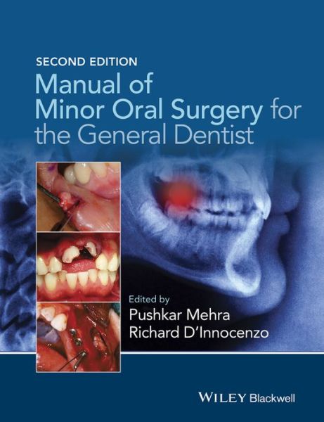 Cover for Mehra, Pushkar (Boston University Henry M. Goldman School of Dental Medicine) · Manual of Minor Oral Surgery for the General Dentist (Paperback Book) (2015)