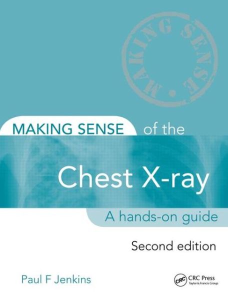 Cover for Paul Jenkins · Making Sense of the Chest X-ray: A hands-on guide - Making Sense of (Paperback Book) (2013)