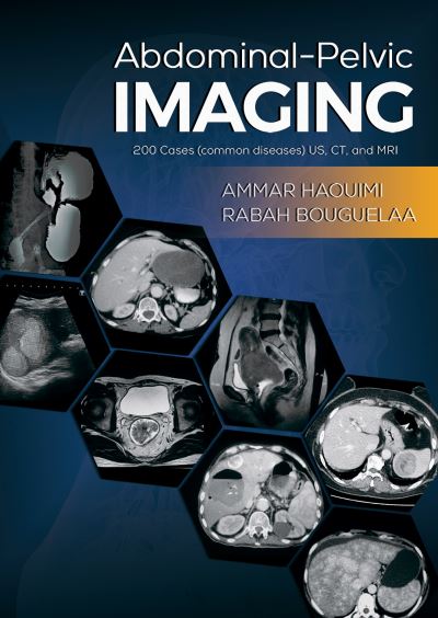 Cover for Ammar Haouimi · Abdominal-Pelvic Imaging: 200 Cases (Common Diseases): US, CT and MRI (Paperback Bog) (2021)