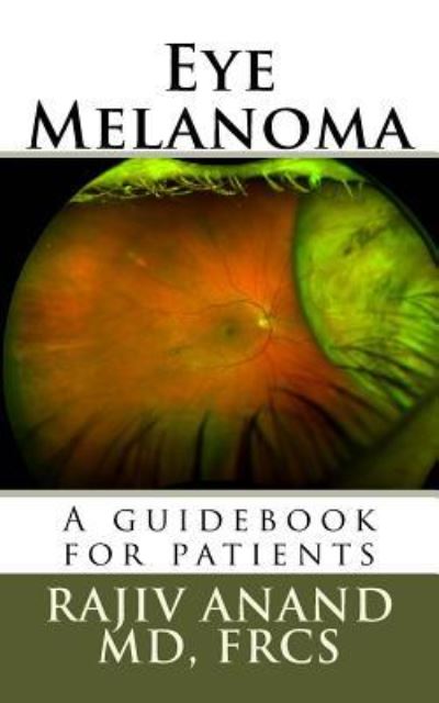 Cover for Rajiv Anand MD · Eye Melanoma (Paperback Book) (2016)