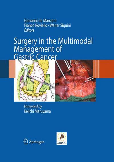 Cover for Surgery in the Multimodal Management of Gastric Cancer (Paperback Book) [Softcover reprint of the original 1st ed. 2012 edition] (2016)