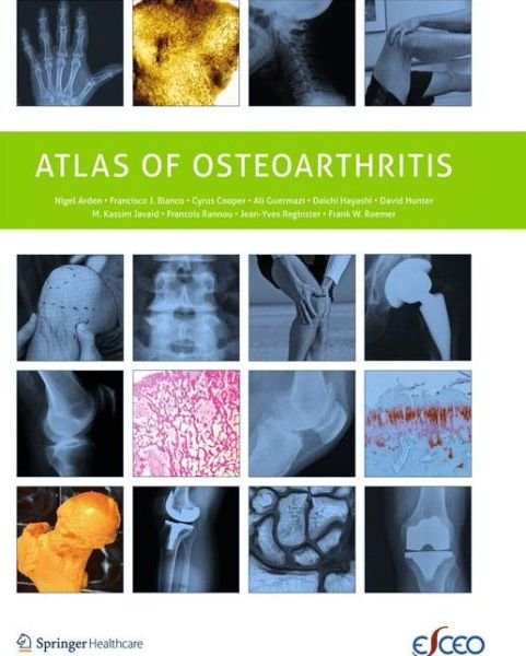 Cover for Nigel Arden · Atlas of Osteoarthritis (Pocketbok) [2014 edition] (2015)