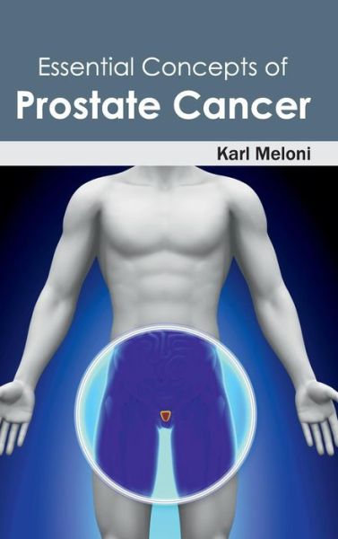 Cover for Karl Meloni · Essential Concepts of Prostate Cancer (Hardcover Book) (2015)