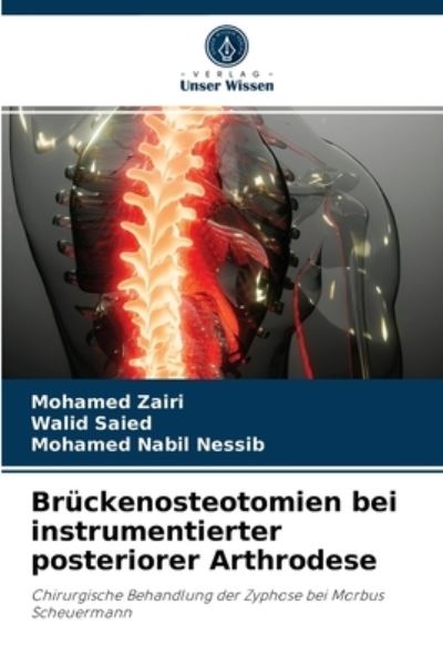 Cover for Mohamed Zairi · Bruckenosteotomien bei instrumentierter posteriorer Arthrodese (Paperback Book) (2021)
