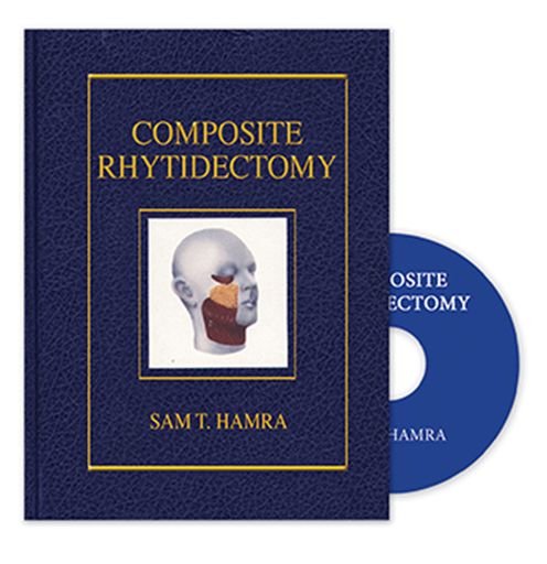 Cover for Sam Hamra · Composite Rhytidectomy (Hardcover bog) (1993)