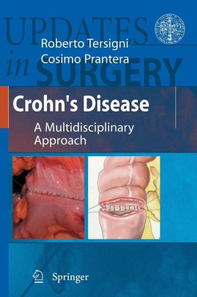 Cover for Roberto Tersigni · Crohn's Disease: A Multidisciplinary Approach - Updates in Surgery (Paperback Book) [Previously published in hardcover edition] (2012)