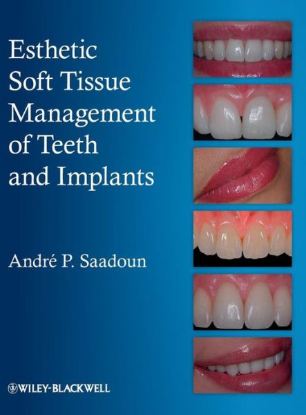 Cover for Saadoun, Andre P. (Private practitioner and internationally renowned lecturer in Esthetic Periodontics and Implant Surgery, Paris, France) · Esthetic Soft Tissue Management of Teeth and Implants (Hardcover Book) (2012)