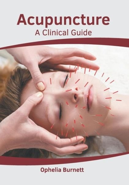 Cover for Ophelia Burnett · Acupuncture: A Clinical Guide (Hardcover Book) (2019)