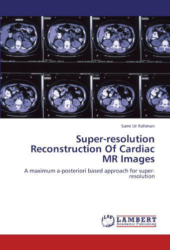 Sami Ur Rahman · Super-resolution Reconstruction of Cardiac Mr Images: a Maximum A-posteriori Based Approach for Super-resolution (Paperback Book) (2011)