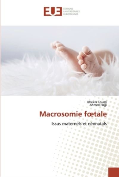 Macrosomie foetale - Toumi - Livres -  - 9786139507160 - 26 juin 2020