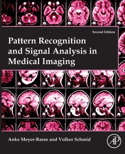 Cover for Anke Meyer-Baese · Pattern Recognition and Signal Analysis in Medical Imaging (Paperback Book) (2016)