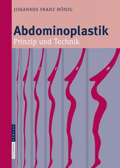 Cover for Johannes-Franz Honig · Abdominoplastik: Prinzip und Technik (Hardcover Book) [German, 1 edition] (2008)