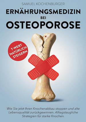 Ernährungsmedizin bei Osteoporose - Samuel Kochenburger - Books - Lucid Page Media - 9783691041163 - March 25, 2025