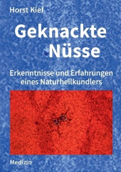 Cover for Horst Kief · Geknackte Nusse: Erkenntnisse und Erfahrungen eines Naturheilkundlers (Paperback Book) (2021)