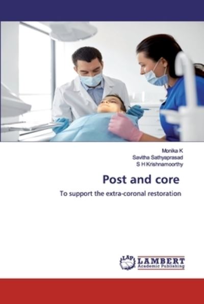 Post and core - K - Livros - - 9786139452163 - 21 de janeiro de 2020