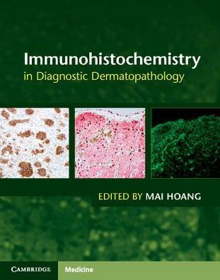 Immunohistochemistry in Diagnostic Dermatopathology - Mai P Hoang - Boeken - Cambridge University Press - 9781107150164 - 28 september 2017