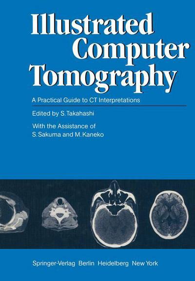 Cover for S Takahashi · Illustrated Computer Tomography: A Practical Guide to CT Interpretations (Paperback Book) [Softcover reprint of the original 1st ed. 1983 edition] (2011)