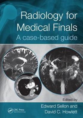 Cover for Edward Sellon · Radiology for Medical Finals: A case-based guide (Paperback Book) (2017)