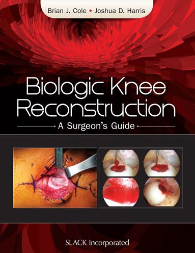 Cover for Brian Cole · Biologic Knee Reconstruction: A Surgeon's Guide (Hardcover Book) (2015)