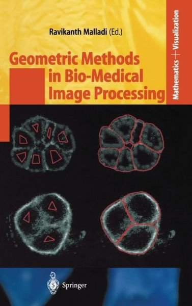 Cover for R Malladi · Geometric Methods in Bio-Medical Image Processing - Mathematics and Visualization (Hardcover bog) [2002 edition] (2002)