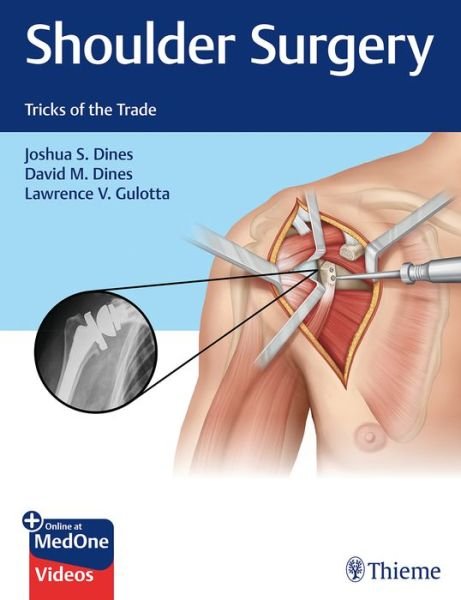Shoulder Surgery: Tricks of the Trade - Joshua Dines - Livros - Thieme Medical Publishers Inc - 9781626235168 - 10 de julho de 2019