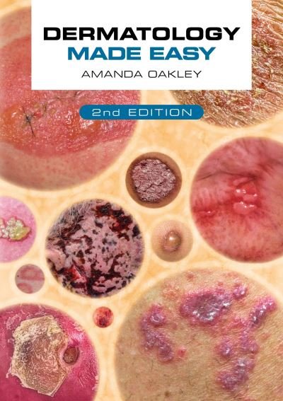 Cover for Oakley, Amanda (Adjunct Associate Professor, Department of Medicine, University of Auckland, New Zealand) · Dermatology Made Easy, second edition (Paperback Book) [2 Revised edition] (2022)