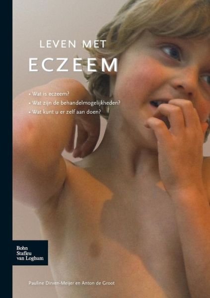 Cover for P E Dirven-Meyer · Leven Met Eczeem (Taschenbuch) [2012 edition] (2011)