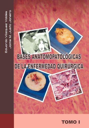Bases Anatomopatológicas De La Enfermedad Quirúrgica - Eduardo Vázquez V. - Książki - Palibrio - 9781463301170 - 3 sierpnia 2011