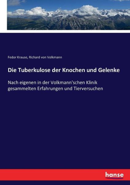 Die Tuberkulose der Knochen und - Krause - Książki -  - 9783743457171 - 26 listopada 2016