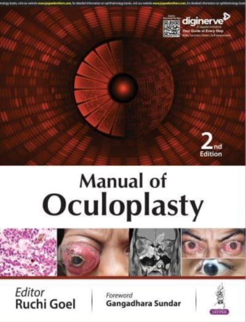 Cover for Ruchi Goel · Manual of Oculoplasty (Paperback Book) [2 Revised edition] (2024)