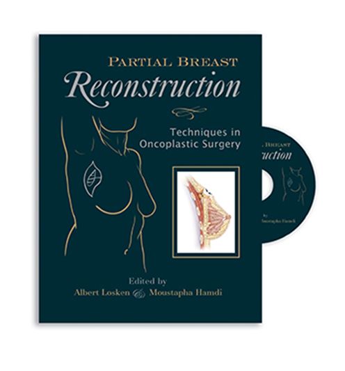 Cover for Albert Losken · Partial Breast Reconstruction: Techniques in Oncoplastic Surgery (Hardcover Book) (2009)