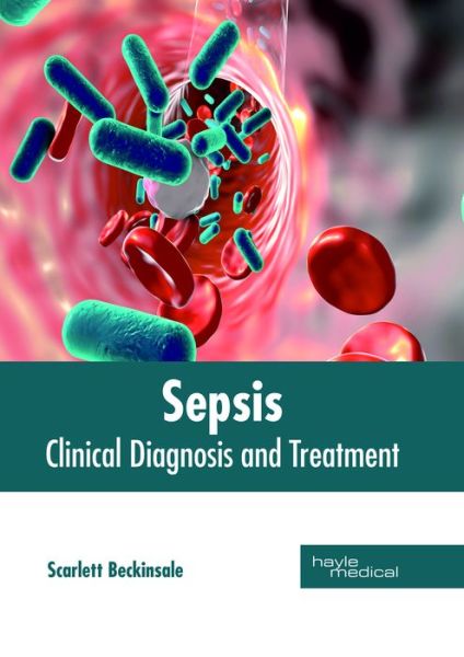 Cover for Scarlett Beckinsale · Sepsis: Clinical Diagnosis and Treatment (Hardcover Book) (2018)