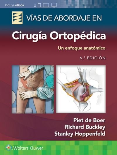 De Boer, Dr. Piet, Md · Vias de abordaje de cirugia ortopedica. Un enfoque anatomico (Paperback Bog) (2022)