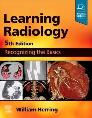 Cover for Herring, William (Vice Chairman and Residency Program Director, Albert Einstein Medical Center, Philadelphia, PA, USA) · Learning Radiology: Recognizing the Basics (Paperback Book) (2023)