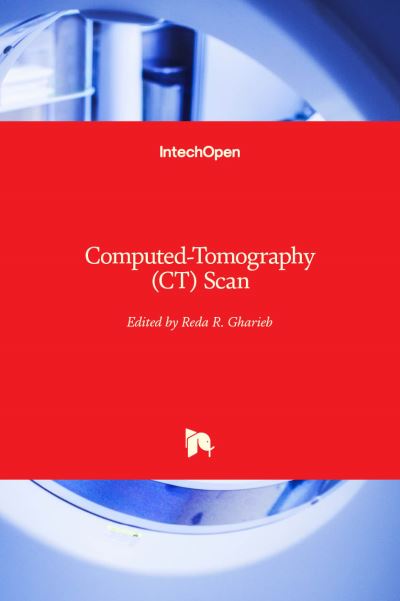 Cover for Reda R. Gharieb · Computed-Tomography (CT) Scan (Hardcover Book) (2022)