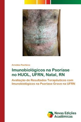 Imunobiológicos na Psoríase no - Pachêco - Bücher -  - 9786202401173 - 23. August 2017